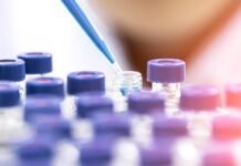 ¿Cómo detectar el VIH? VIH